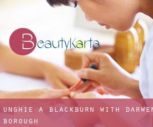 Unghie a Blackburn with Darwen (Borough)
