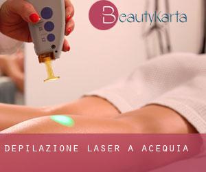 Depilazione laser a Acequia