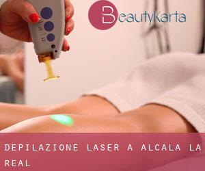 Depilazione laser a Alcalá la Real