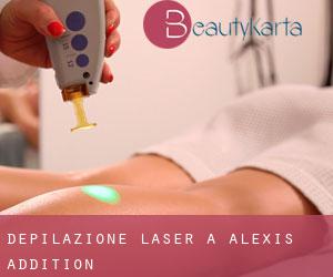 Depilazione laser a Alexis Addition