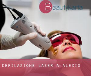 Depilazione laser a Alexis