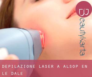 Depilazione laser a Alsop en le Dale