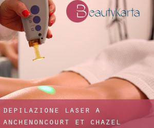 Depilazione laser a Anchenoncourt-et-Chazel