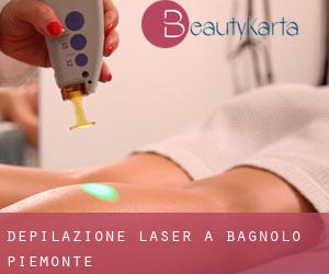 Depilazione laser a Bagnolo Piemonte