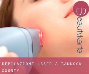 Depilazione laser a Bannock County