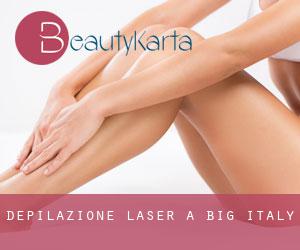 Depilazione laser a Big Italy