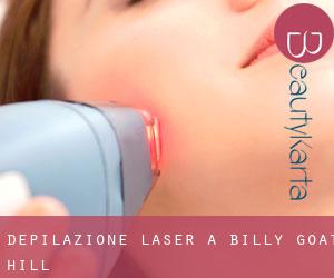 Depilazione laser a Billy Goat Hill