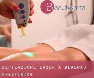 Depilazione laser a Blaenau-Ffestiniog