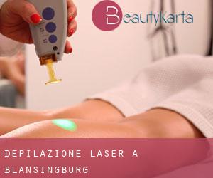 Depilazione laser a Blansingburg