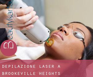 Depilazione laser a Brookeville Heights