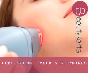 Depilazione laser a Brownings
