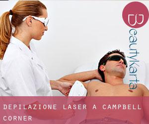 Depilazione laser a Campbell Corner