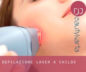 Depilazione laser a Childs