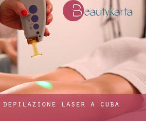 Depilazione laser a Cuba