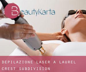 Depilazione laser a Laurel Crest Subdivision