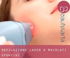 Depilazione laser a Maiolati Spontini