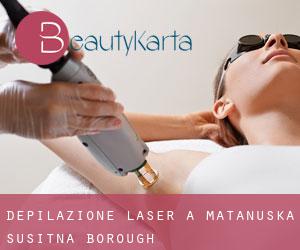 Depilazione laser a Matanuska-Susitna Borough Depilazione laser a Matanuska-Susitna Borough