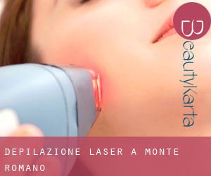 Depilazione laser a Monte Romano