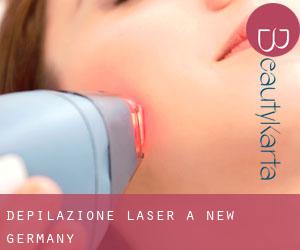 Depilazione laser a New Germany