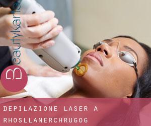 Depilazione laser a Rhosllanerchrugog