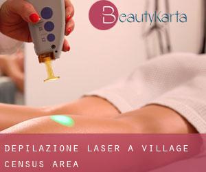 Depilazione laser a Village (census area)