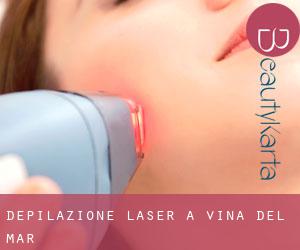 Depilazione laser a Viña del Mar Depilazione laser a Viña del Mar