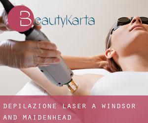 Depilazione laser a Windsor and Maidenhead