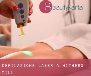 Depilazione laser a Withers Mill