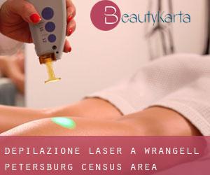 Depilazione laser a Wrangell-Petersburg Census Area Depilazione laser a Wrangell-Petersburg Census Area