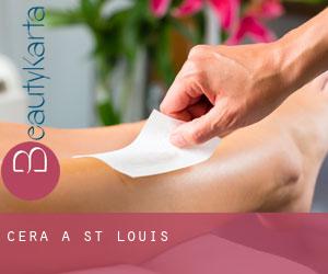 Cera a St. Louis Cera a St. Louis