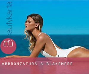 Abbronzatura a Blakemere