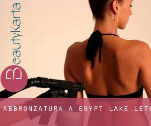 Abbronzatura a Egypt Lake-Leto
