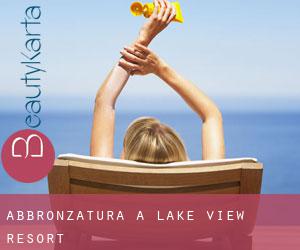 Abbronzatura a Lake View Resort