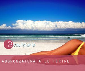 Abbronzatura a Le Tertre Abbronzatura a Le Tertre