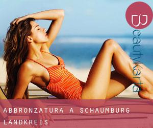 Abbronzatura a Schaumburg Landkreis Abbronzatura a Schaumburg Landkreis