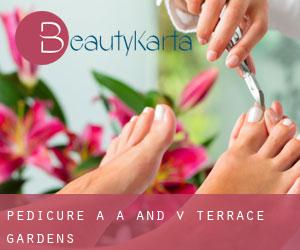 Pedicure a A and V Terrace Gardens