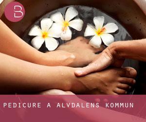 Pedicure a Älvdalens Kommun