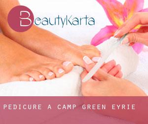 Pedicure a Camp Green Eyrie