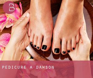 Pedicure a Dawson Pedicure a Dawson
